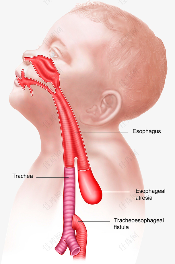 儿童鼻腔气管结构
