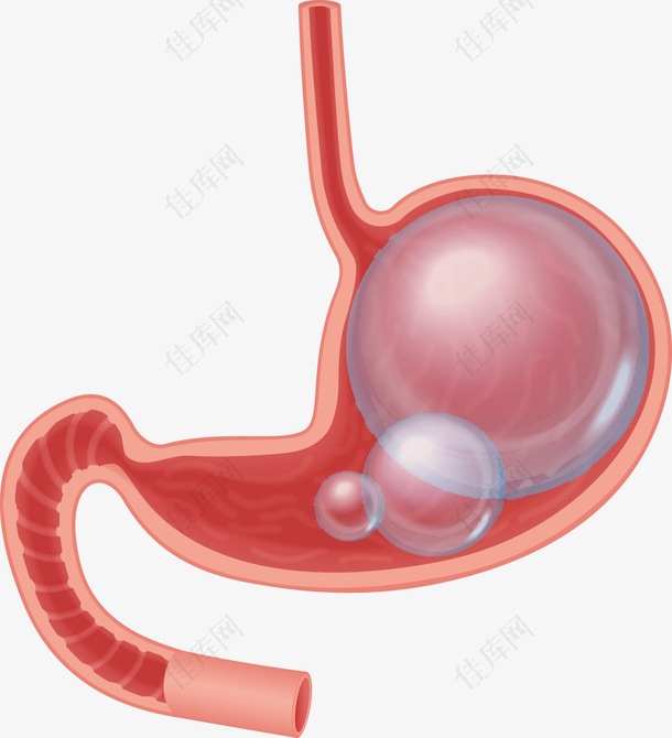 胃胀气的胃的内部图